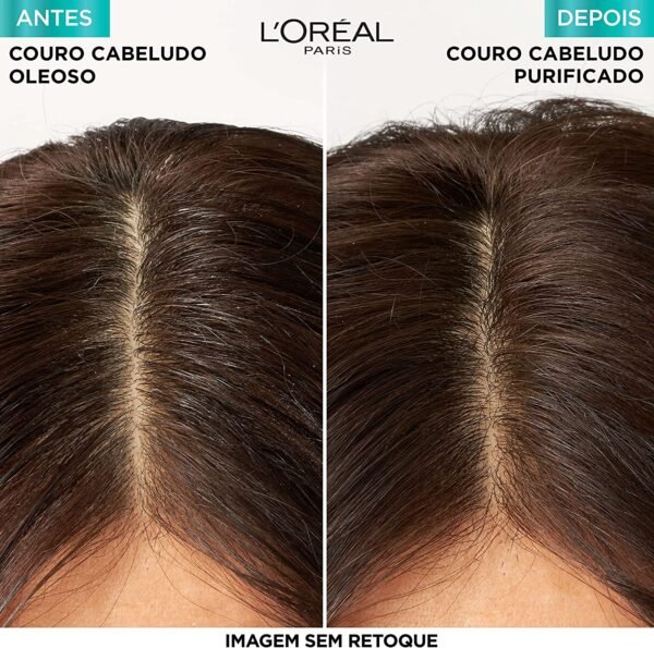 Elseve Haircare Shampoo L'Oréal Paris Elseve Pure Hialurônico 200Ml - Image 6